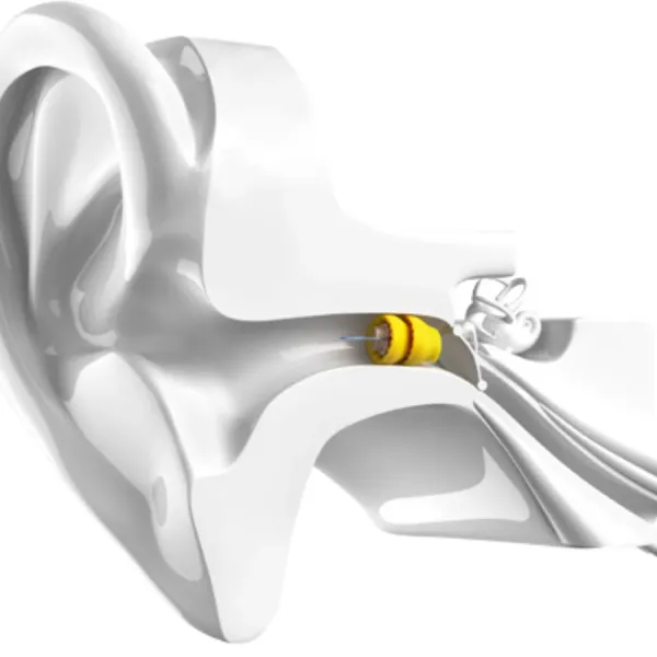 Phonak Lyric hearing aid